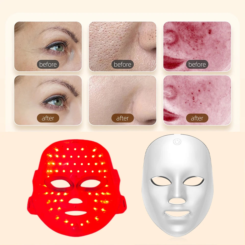 7-Color LED Facial Mask — Skin Rejuvenation & Anti-Aging